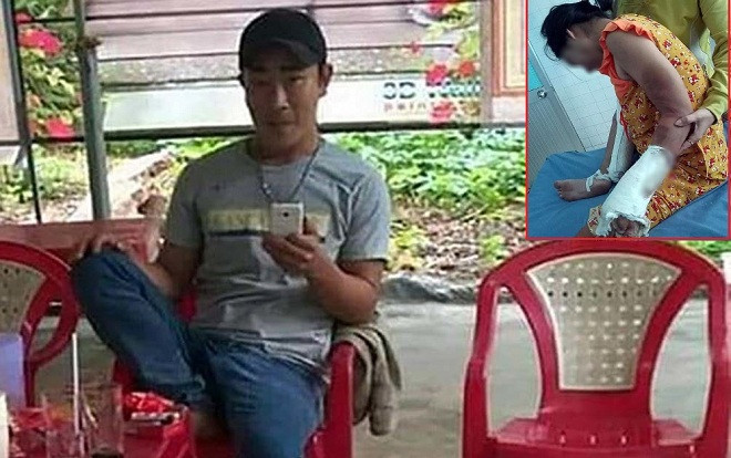 Chồng đánh đập tàn nhẫn vợ mang thai 7 tháng đến mức phải nhập viện cấp cứu Ảnh 2