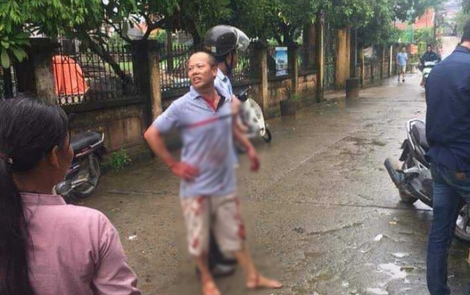 Hé lộ nguyên nhân anh vác dao truy sát gia đình em trai khiến 2 người tử vong, 3 người nguy kịch Ảnh 2