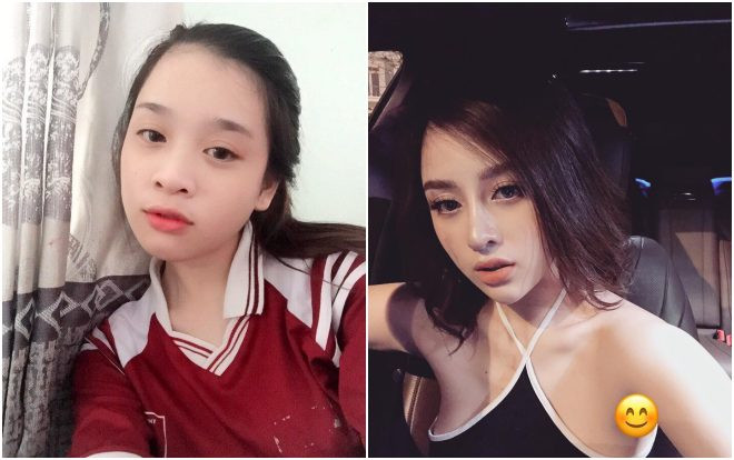 Công khai sửa mũi, gái xinh 19 tuổi bỗng bị đồn 'sửa nát mặt' vì màn dậy thì thành công quá ấn tượng Ảnh 2