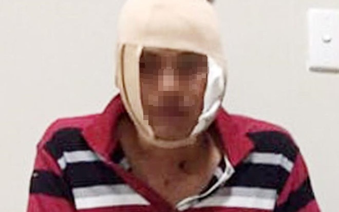 Ôm hận vì bị phạt vi phạm giao thông, người đàn ông đánh đại úy công an tại quán nhậu gây thương tích Ảnh 2