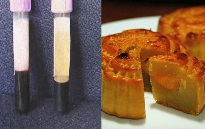 Tiếc rẻ bánh trung thu, người đàn ông ăn 4 chiếc mỗi ngày khiến máu có màu trắng đục Ảnh 2