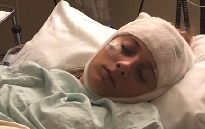 Cô gái cứ 2 tiếng lại mất trí nhớ sau khi bị đá vào đầu Ảnh 2