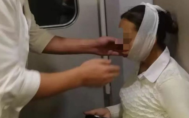 Dở khóc dở cười người phụ nữ không khép được mồm do lỡ cười quá trớn Ảnh 2