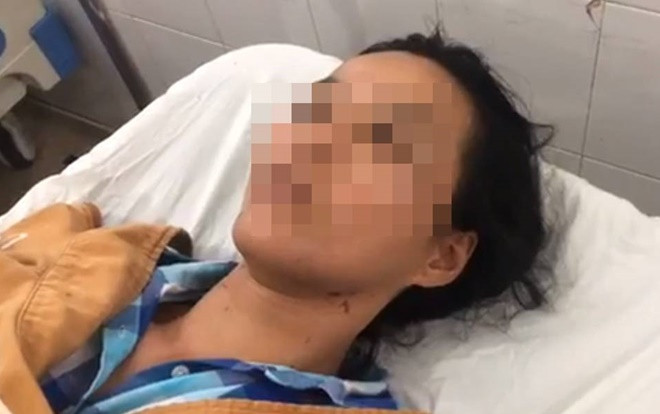 Người vợ bị chồng hành hung dã man trước sự chứng kiến của 2 con nhỏ: Không nhớ nổi bao nhiêu lần bị bạo hành Ảnh 2