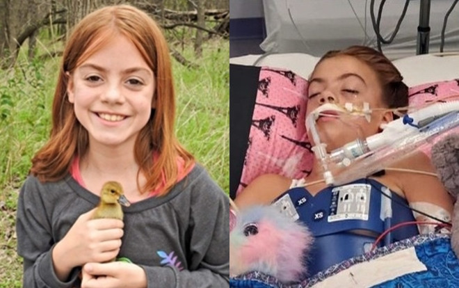 Bé gái 10 tuổi tử vong vì nhiễm amip ăn não người sau khi bơi ở sông Ảnh 2