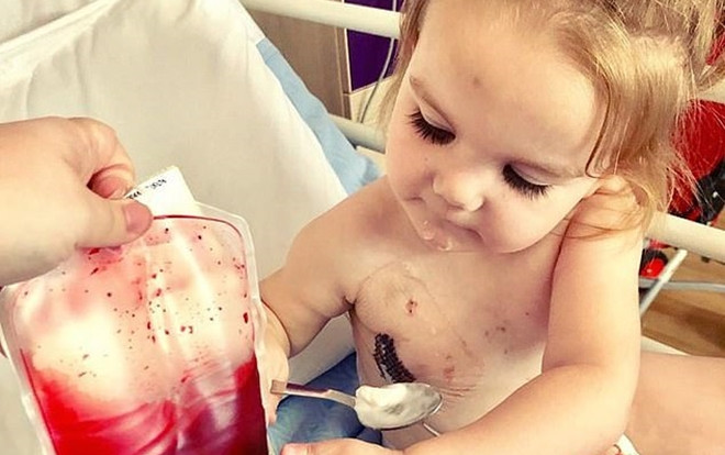 Cô bé 2 tuổi mắc bệnh lạ chỉ có thể sống nhờ máu người khác Ảnh 2
