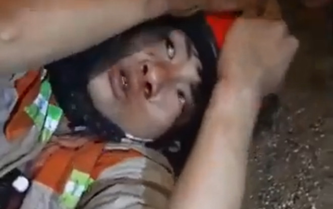 Tri hô ngăn cản 2 đối tượng trộm chó ở Hà Nội, 2 vợ chồng bị chém trọng thương Ảnh 2