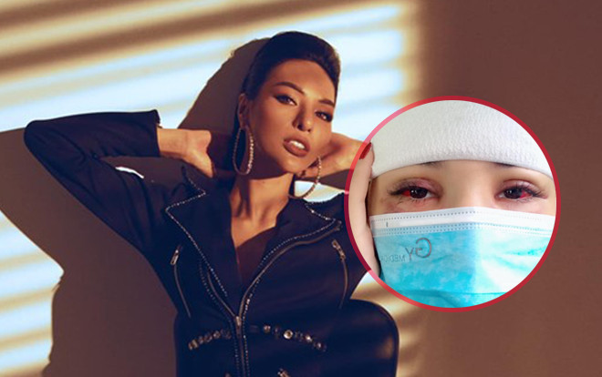 Khả Trang khiến đồng nghiệp và fan lo 'sốt vó' với hình ảnh băng kín đầu và tụ máu do tai nạn Ảnh 2