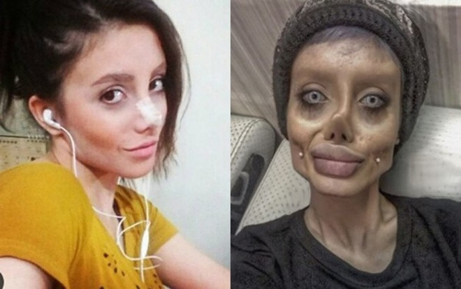 Cô gái 'xác sống' giống Angelina Jolie bị bắt Ảnh 2