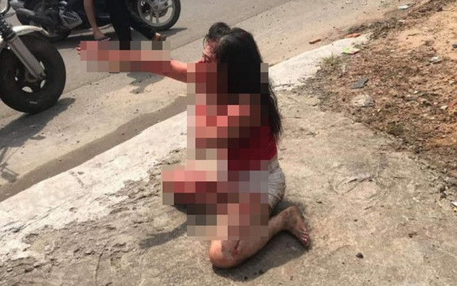 Nữ nhân viên quán cà phê bị người tình cũ nhẫn tâm dùng dao rạch nhiều nhát vào mặt Ảnh 2