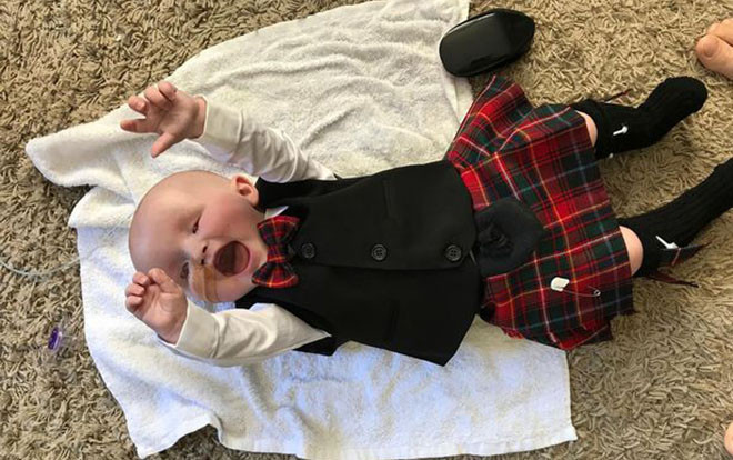 Nghị lực sống phi thường của cậu bé mắc hội chứng hiếm gặp, sinh ra đã không có mắt Ảnh 2