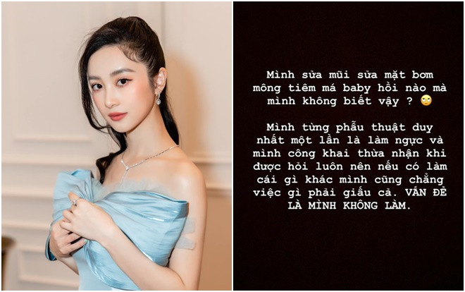 Bị 'tố' phẫu thuật thẩm mỹ toàn bộ gương mặt, Jun Vũ bức xúc 'đáp trả' anti-fan và khẳng định chỉ 'dao kéo' một chỗ duy nhất Ảnh 2