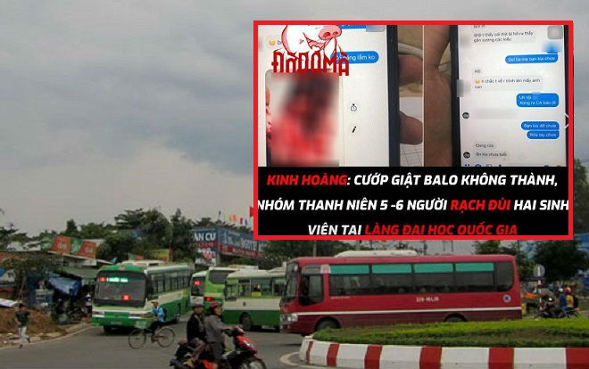 ĐH Quốc tế TP.HCM khẳng định vụ sinh viên bị nhóm người lạ mặt rạch đùi sau khi giật balo bất thành là thông tin bịa đặt Ảnh 2