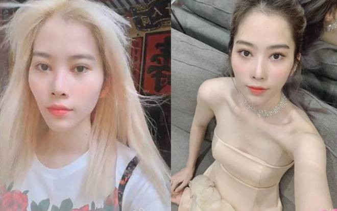 Nam Em gầy rộc vì giảm cân quá đà khiến fan lo lắng Ảnh 2