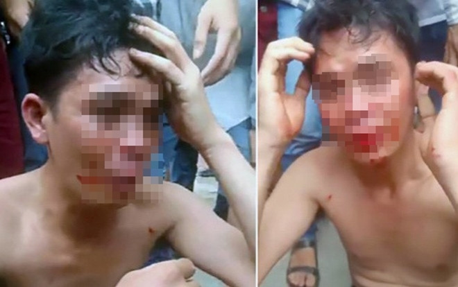 Vụ Facebooker Đàm Vĩnh Hưng kích động bạo lực: Đại biểu Quốc hội đề nghị xử lý nghiêm minh Ảnh 2