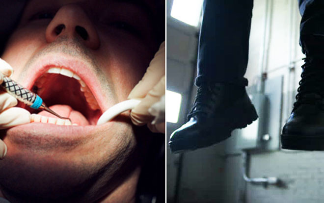 Răng khôn đau buốt mà mãi không được nhổ, người đàn ông uất ức làm liều Ảnh 2