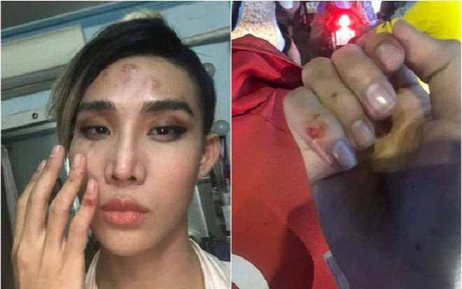 Bị người mẫu The Face Mid Nguyễn tố hành hung, tài xế Go Viet bị khóa app Ảnh 2