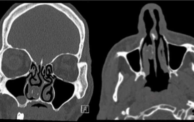 Tù nhân nhét cần sa vào mũi để buôn lậu và cái kết đau đớn sau 18 năm Ảnh 2