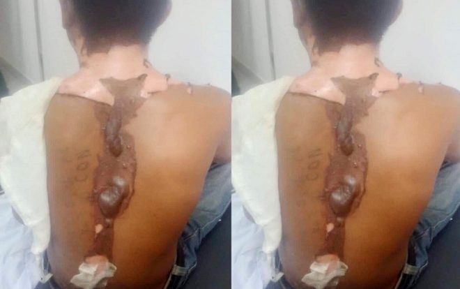 Cha ruột tiết lộ lý do nam thanh niên bị chị gái tạt nước sôi lên người gây bỏng nặng Ảnh 2