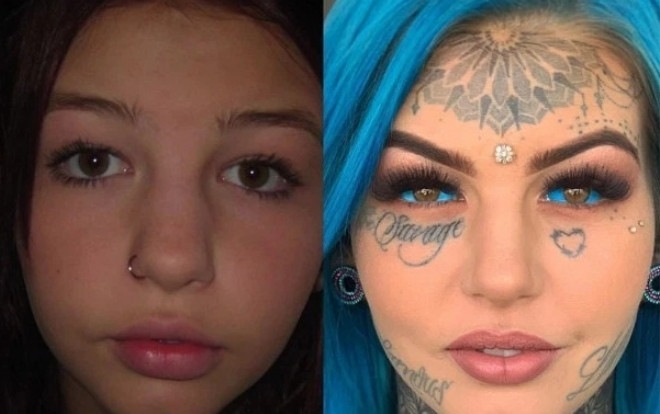 Bạo gan xăm nhãn cầu thành màu xanh, cô gái bị mù hơn nửa tháng Ảnh 2