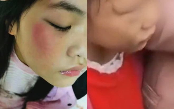 Giáo viên dạy thay đánh học sinh tiểu học dã man chỉ vì… viết sai một chữ Ảnh 2