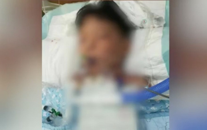 Bé trai 5 tuổi nguy kịch nghi do nuốt nhầm thuốc diệt chuột tại trường mẫu giáo Ảnh 2