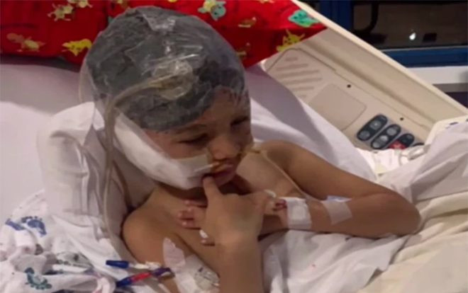 Trông chừng chó của người quen, bé trai 6 tuổi bị cắn đứt tai Ảnh 2