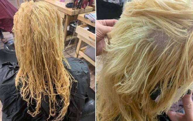 Tự tay dùng thuốc tẩy tóc tại nhà, cô gái hoảng hốt khi tóc rụng từng mảng trọc cả đầu Ảnh 2