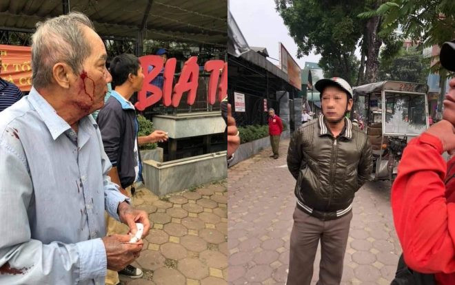 Cựu binh 80 tuổi bị tài xế xe ôm đánh chảy máu đầu, rạn xương gây phẫn nộ Ảnh 2