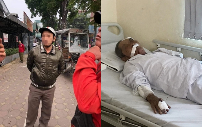Giây phút cựu binh 80 tuổi bị tài xế xe ôm hành hung chấn thương, rạn xương sườn phải nhập viện điều trị Ảnh 2