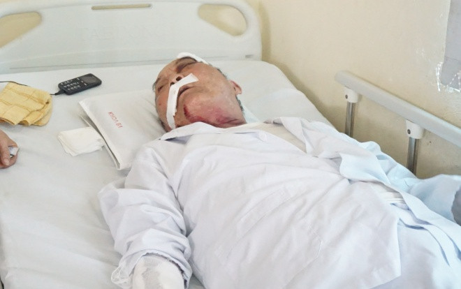 Cựu binh 80 tuổi bị lái xe ôm hành hung rạn xương sườn: 'Tôi ra hóng gió thôi chứ có tranh giành khách đâu mà đánh tôi dã man quá' Ảnh 2