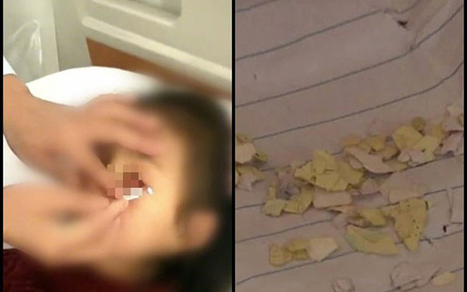 Bé gái bị bạn học nhét giấy vào mắt, thái độ của hiệu trưởng khiến ai nấy đều phẫn nộ Ảnh 2