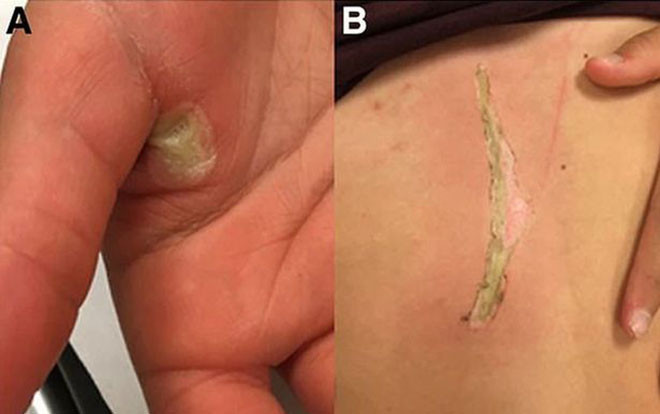 Đánh rơi điện thoại đang sạc xuống bồn tắm, bé gái bị điện giật suýt chết Ảnh 2