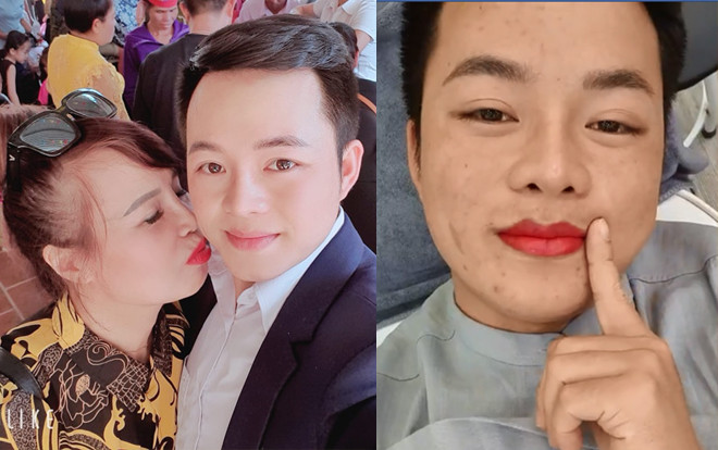 Chưa hài lòng với nhan sắc, 'cô dâu 62 tuổi' đưa chồng đi xăm môi đỏ chót khiến dân tình 'kinh hồn bạt vía' Ảnh 2