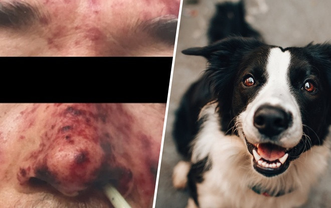 Người đàn ông tử vong vì vết liếm của chó cưng Ảnh 2