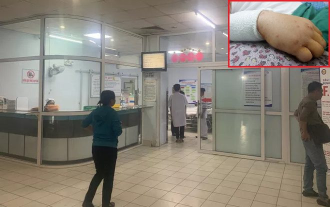 Kinh hoàng lời kể của nam thanh niên bị nhóm côn đồ chém gần đứt lìa tay ở Sài Gòn Ảnh 2