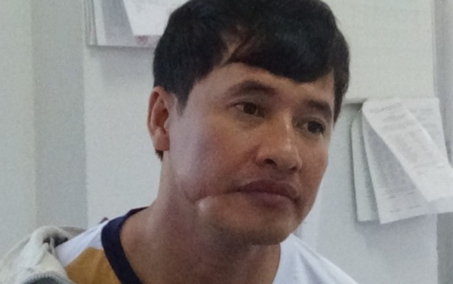 Bắt đối tượng chém lìa ngón tay thanh tra giao thông khi đi dẹp vỉa hè ở Đồng Tháp Ảnh 2