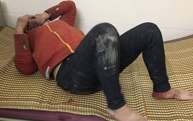 Nổi cơn ghen tuông, gã trai trẻ hẹn người tình lớn tuổi nói chuyện rồi đánh đập dã man Ảnh 2