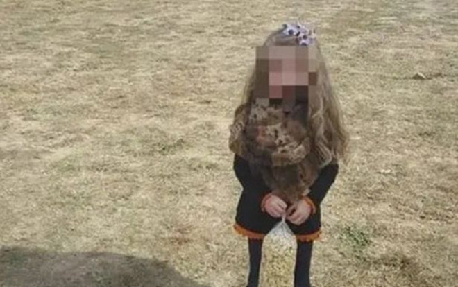 Sự thật 'không đỡ nổi' sau bức ảnh cô bé gầy giơ xương khiến dân tình thương xót Ảnh 2