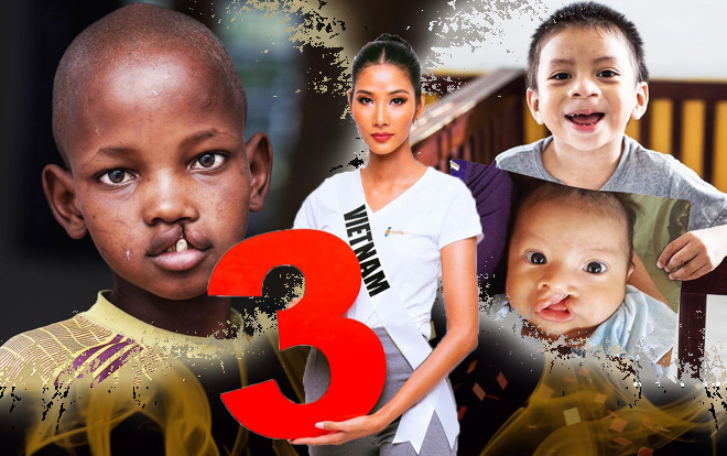 Hoàng Thùy tự hào khoe vết sẹo trên trán tại Miss Universe, fan quốc tế trầm trồ: 'Thật sự truyền cảm hứng' Ảnh 2