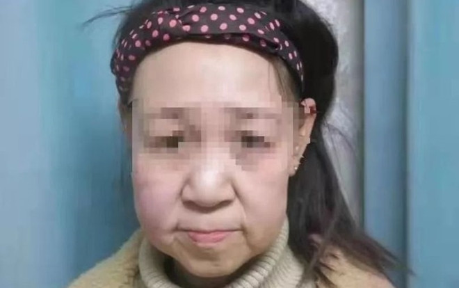 Thiếu nữ 15 tuổi bị gọi là 'quái vật' vì gương mặt như bà lão 60 Ảnh 2