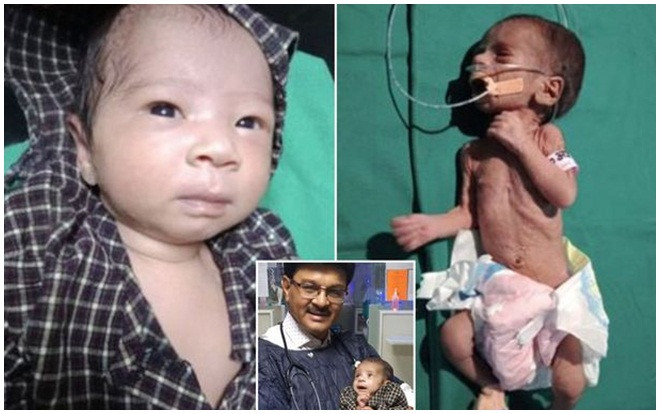 Bé gái sơ sinh bị chôn sống vài ngày hồi sinh kỳ diệu Ảnh 2