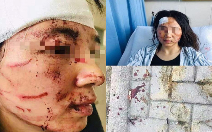 Nghi ngoại tình, gã chồng cùng bố hợp lực đánh đập vợ dã man ngay trên phố Ảnh 2