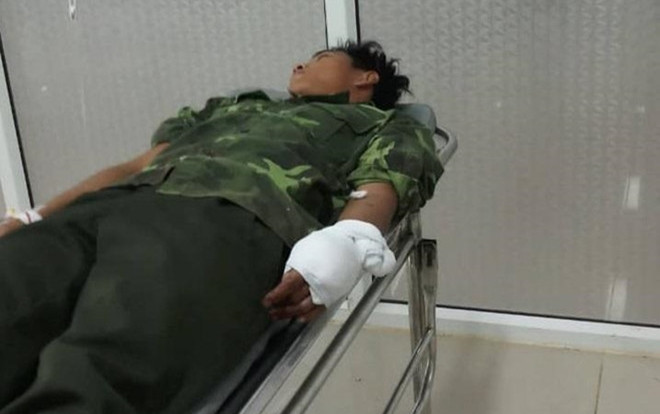 Nhóm lâm tặc dùng hung khí chém đứt gân tay một kiểm lâm để giải cứu đồng bọn Ảnh 2