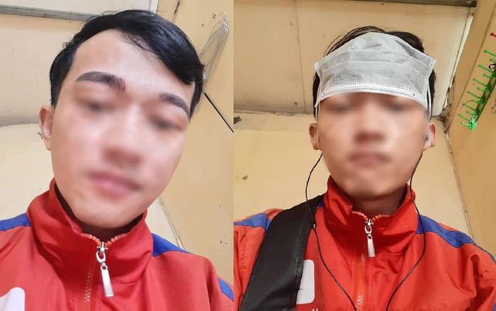 'Đỡ không nổi' với màn điêu khắc lông mày thảm họa của nam thanh niên muốn 'một lần chơi lớn xem thiên hạ có trầm trồ' Ảnh 2