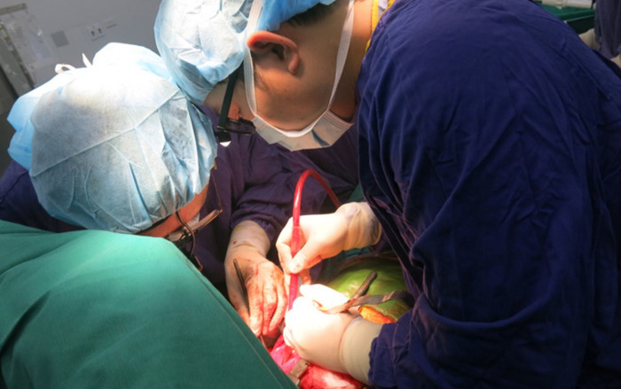 Hai ca ghép tạng đặc biệt lần đầu tiên tại Việt Nam từ tạng của thanh niên 19 tuổi Ảnh 2