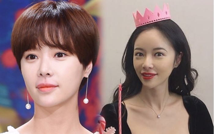 Knet sốc khi gương mặt Hwang Jung Eum biến dạng vì lạm dụng phẫu thuật thẩm mỹ Ảnh 2