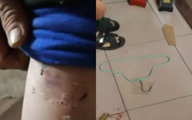 Người đàn ông khuyết tật tố bị vợ bạo hành trong nhiều năm và phản ứng gay gắt của cộng đồng mạng Ảnh 2