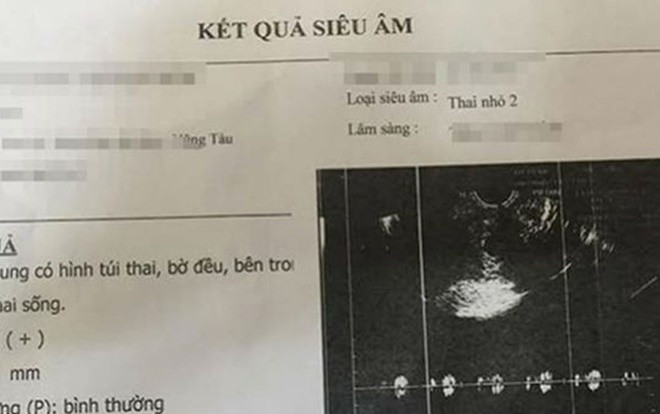 Thiếu nữ 15 tuổi làm giả giấy siêu âm thai để níu kéo tình cảm Ảnh 2