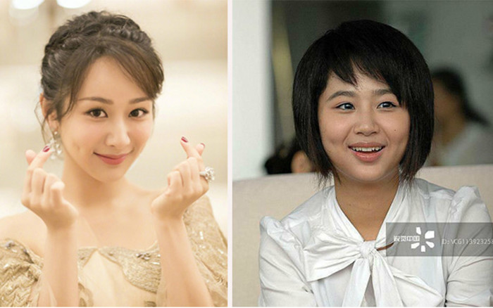 Dương Tử bị trung tâm thẩm mỹ lấy ảnh để minh họa trước và sau khi chỉnh sửa nhan sắc Ảnh 2